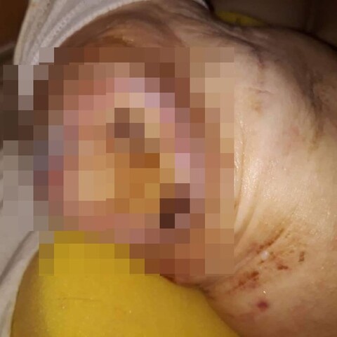 Czytelniczka: Tak szpital potraktował mamę