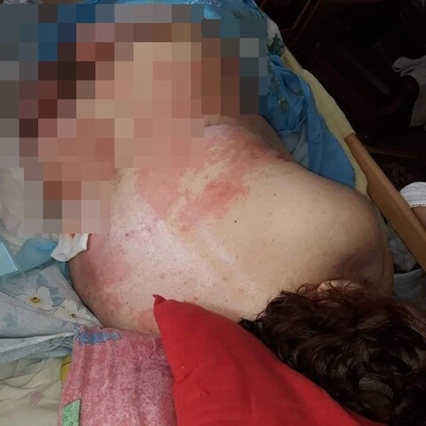 Czytelniczka: Tak szpital potraktował mamę