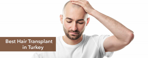 Why Capilclinic Is One of the Best Hair Transplant Clinics in Turkey?